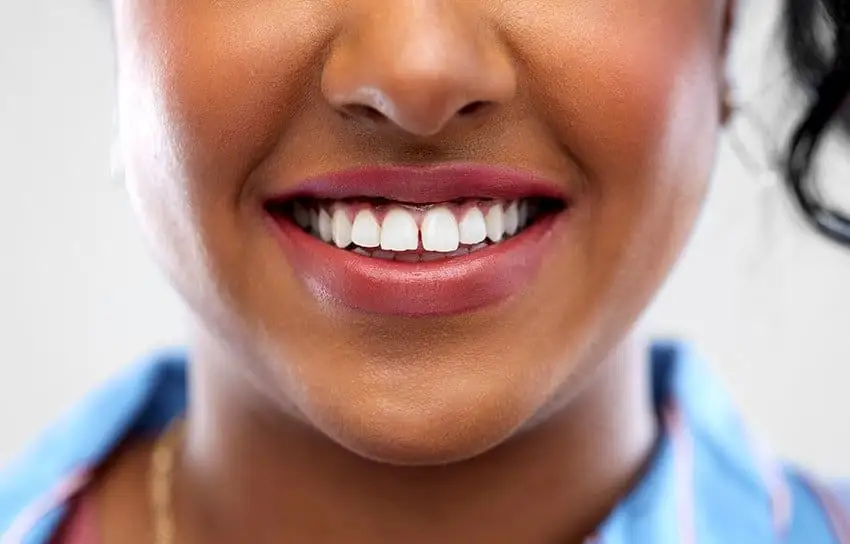 How to Get Rid of Gap Teeth