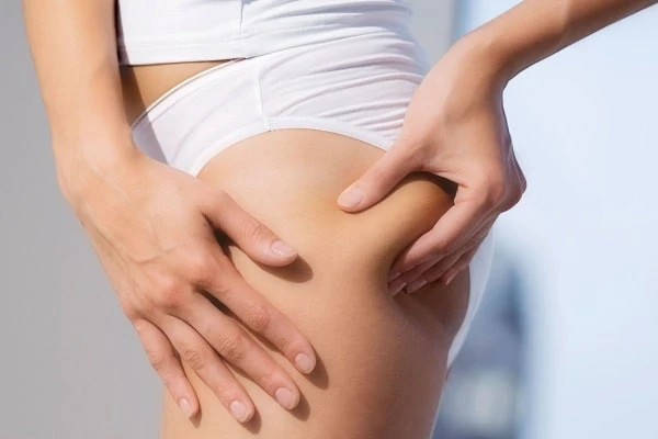 How to Reduce Cellulite on Legs and Buttocks